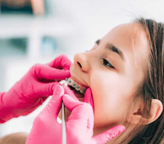 How Soon Is Too Soon to Bring Your Child to an Orthodontist?